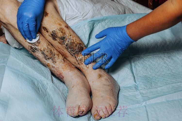 跟队记者:米利唐右大腿受伤 具体伤愈时间未知 跟队记者:米利唐右大腿受伤 具体伤愈时间未知